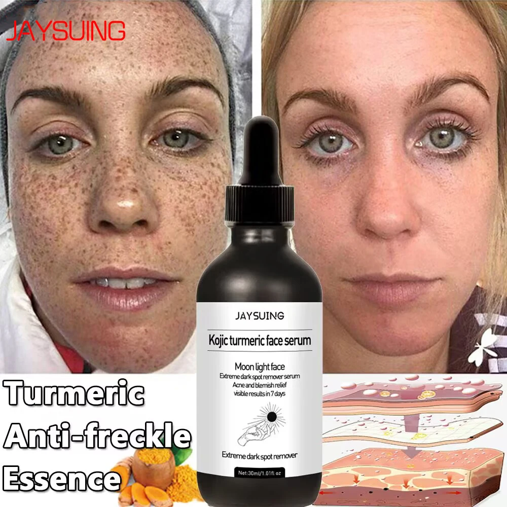 

Turmeric Whitening Freckles Face Serum Remove Dark Spots Melasma Lighten Melanin Essence Acne Scar Anti-aging Brighten Skin Care