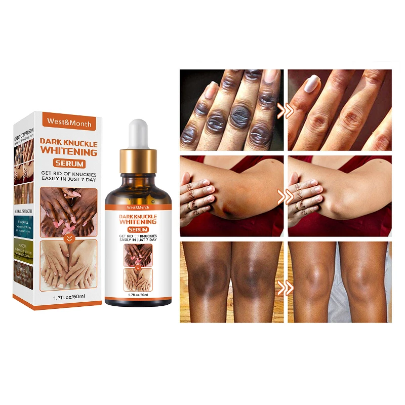 Skin Lightening Cream For Dark Skin Bleaching Cream Dark ...