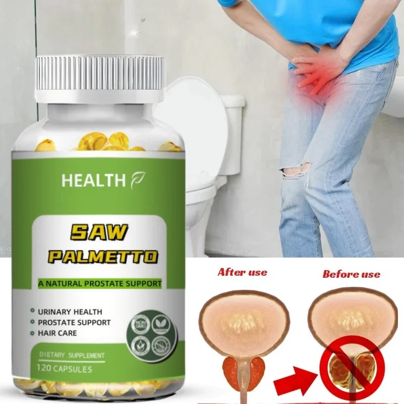 Saw Palmetto Extract 120 Capsules Non-GMO Gluten Free
