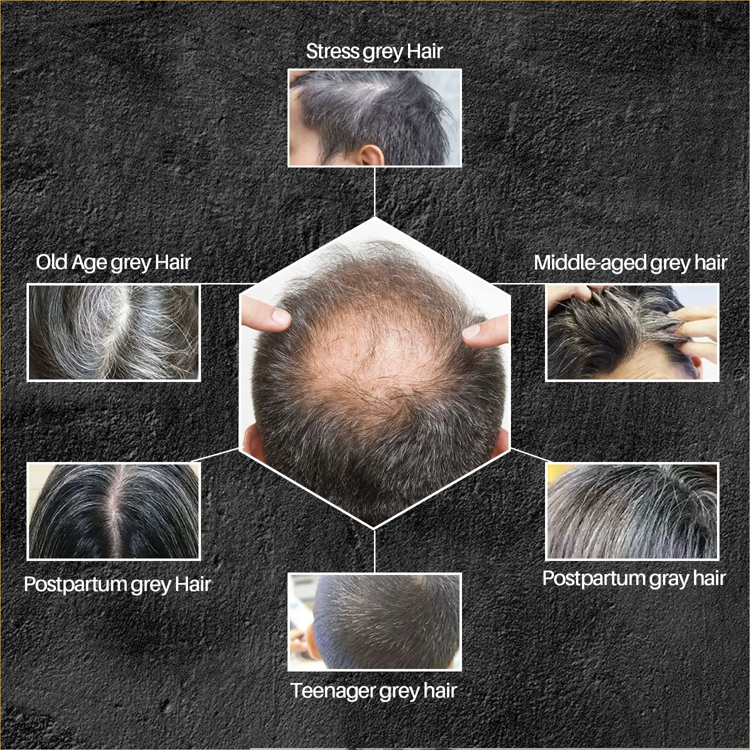 Polygonum Multiflorum Shampoo Soap Darken Hair Color Cover Gray Dye Canas White To Black hair dye shampoo hair shampoo bar plant shampoo soap hair shampoo hair darkening soap