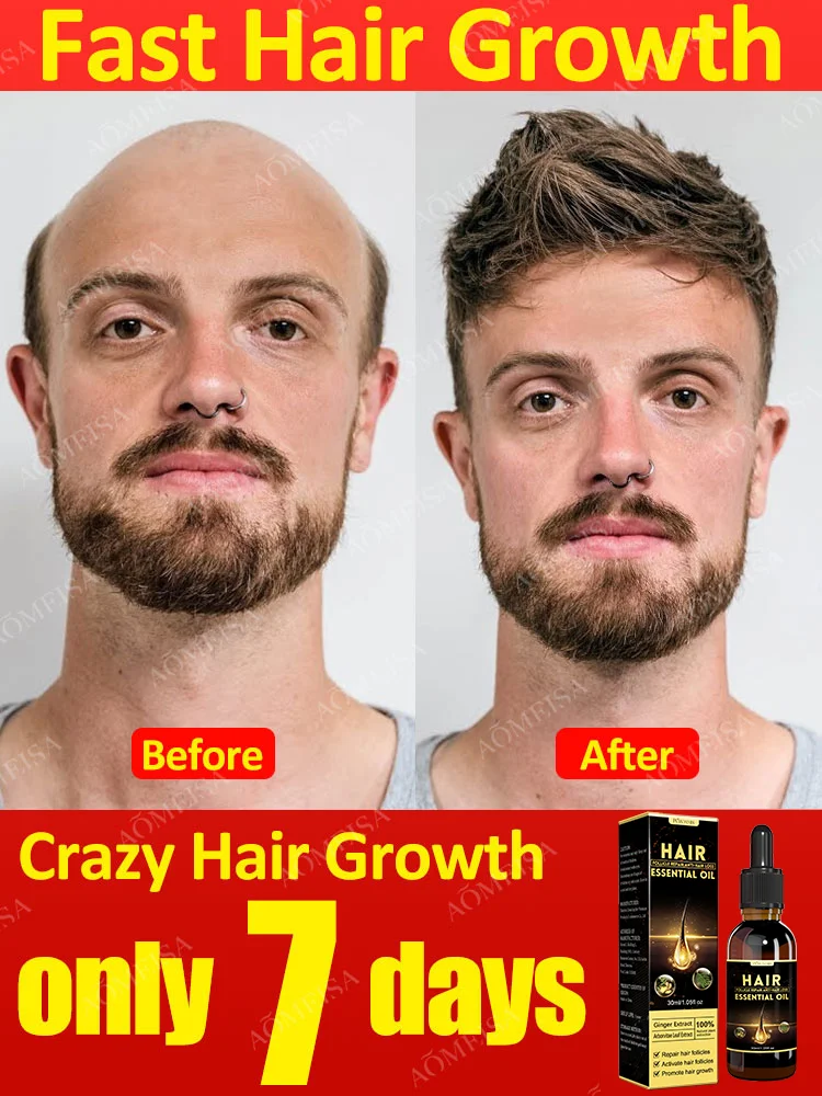 Hair Treatment Oil Hair Treatment Scalp Treatment Rapid hair growth serum treating alopecia areata seborrheic alopecia hereditary alopecia etc.