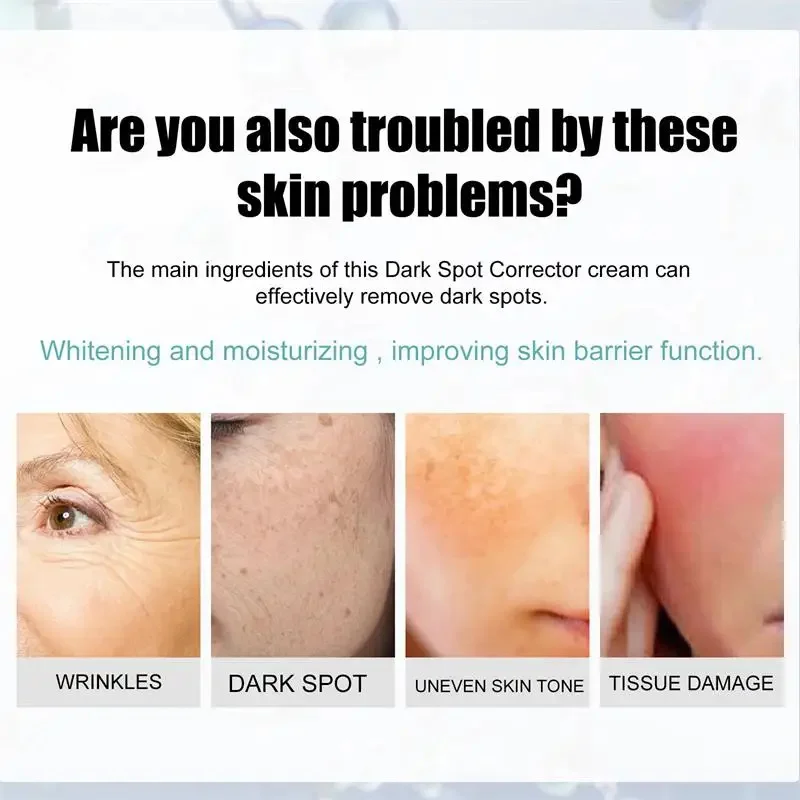 Whitening Body Cream Effective Whitening Freckle Cream Remove Dark Spot Lotion Removal Melanin Melasma Lighten Brighten Anti-Aging Skin Care Products,facial cream