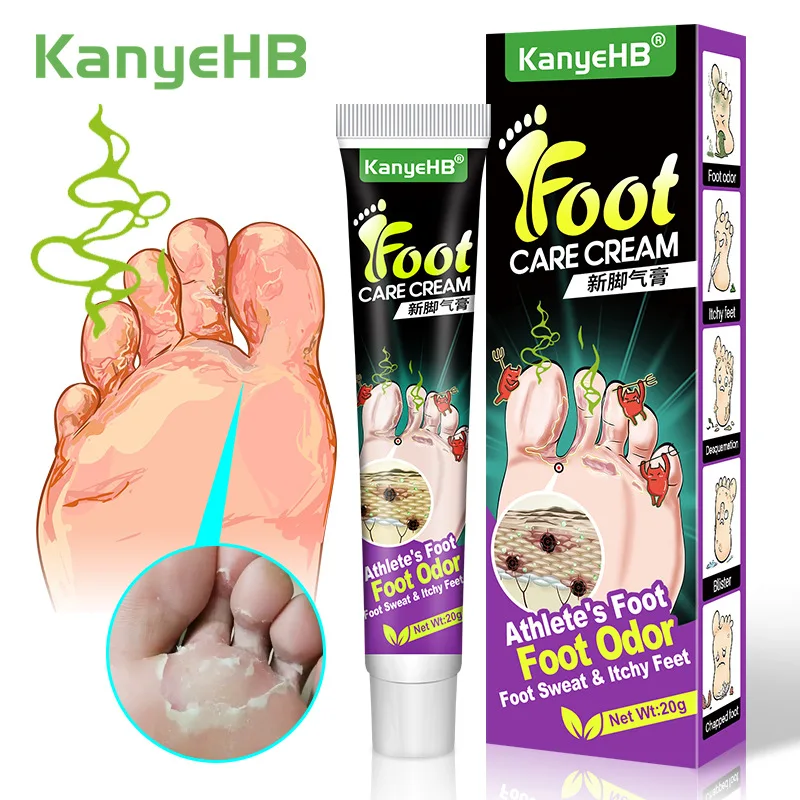 Personal Health Care Pain Analgesic Cream 20g Beriberi Treatment Anti Fungal Infections Foot Cream Anti-itch Athlete Relief Itch Erosion Peeling Blisters Medical Plaste