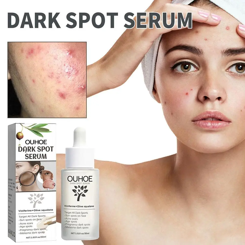 

Dark Spots Acne Remove Essence Fade Spots Acne Marks Freckle Moisturizing Brighten Whitening Skin Repair Facial Dullness Serum