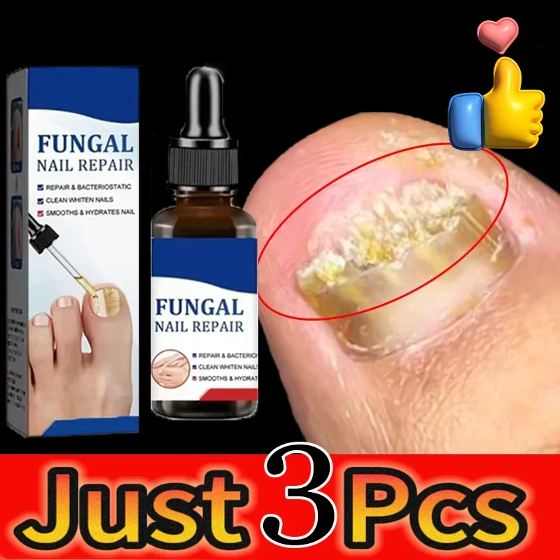 Fungal Nail Laser Treatment Device Repair Toenail Anti Infection Paronychia Onychomycosis Ingrown Toenail Foot Care Essenc