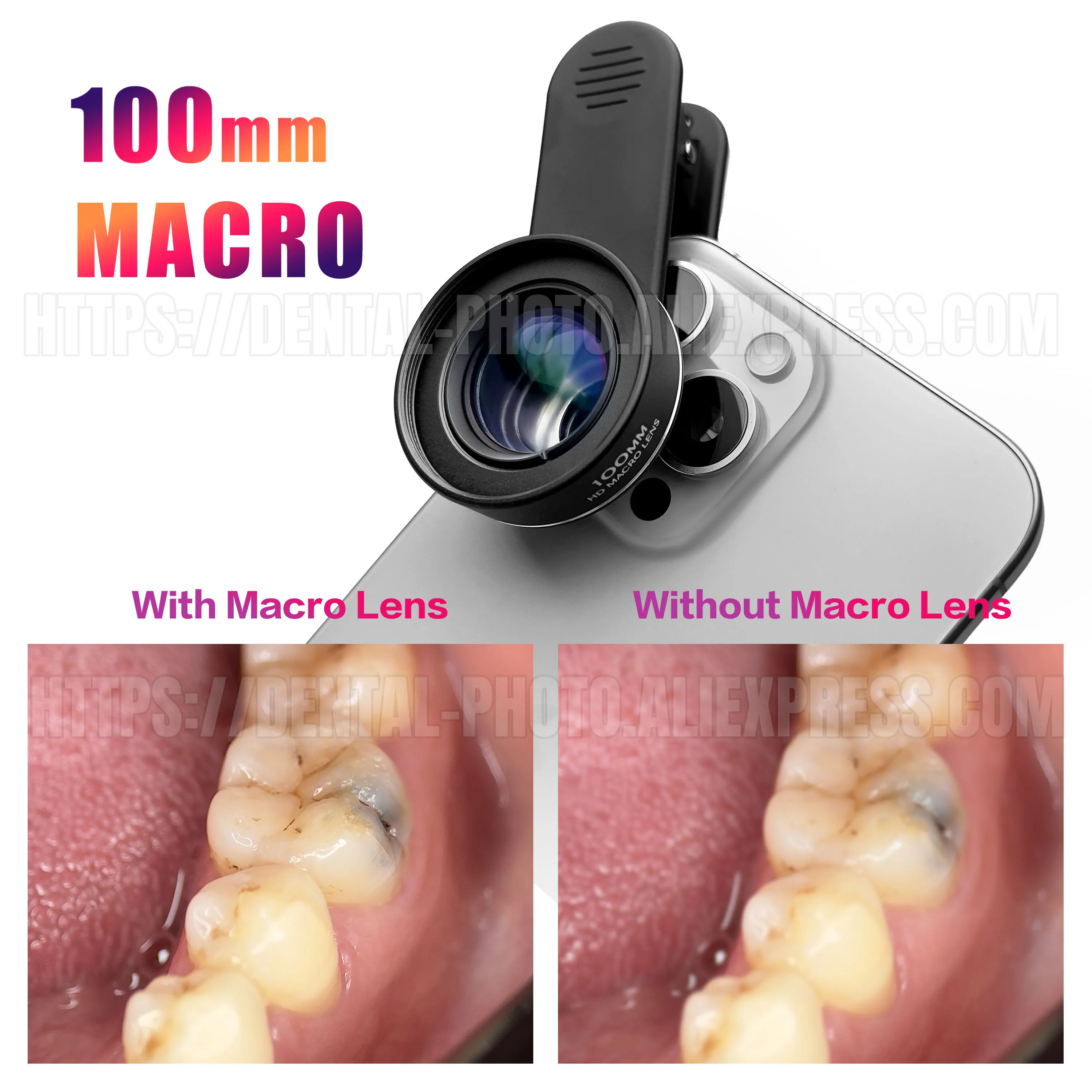 Macro Lens Hd Camera Lens For Mobile [New] Apexel ZoomMacro 10x