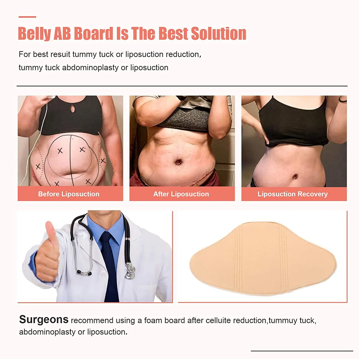 Lipo Board After Tummy Tuck