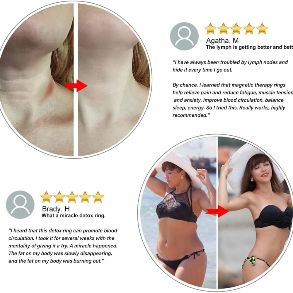 Lymphatic Drainage Lovers Ring Bracelet Relieve Fatigue For Men And Women Resizable Magnet Rings Weight Lose Health Care Gift