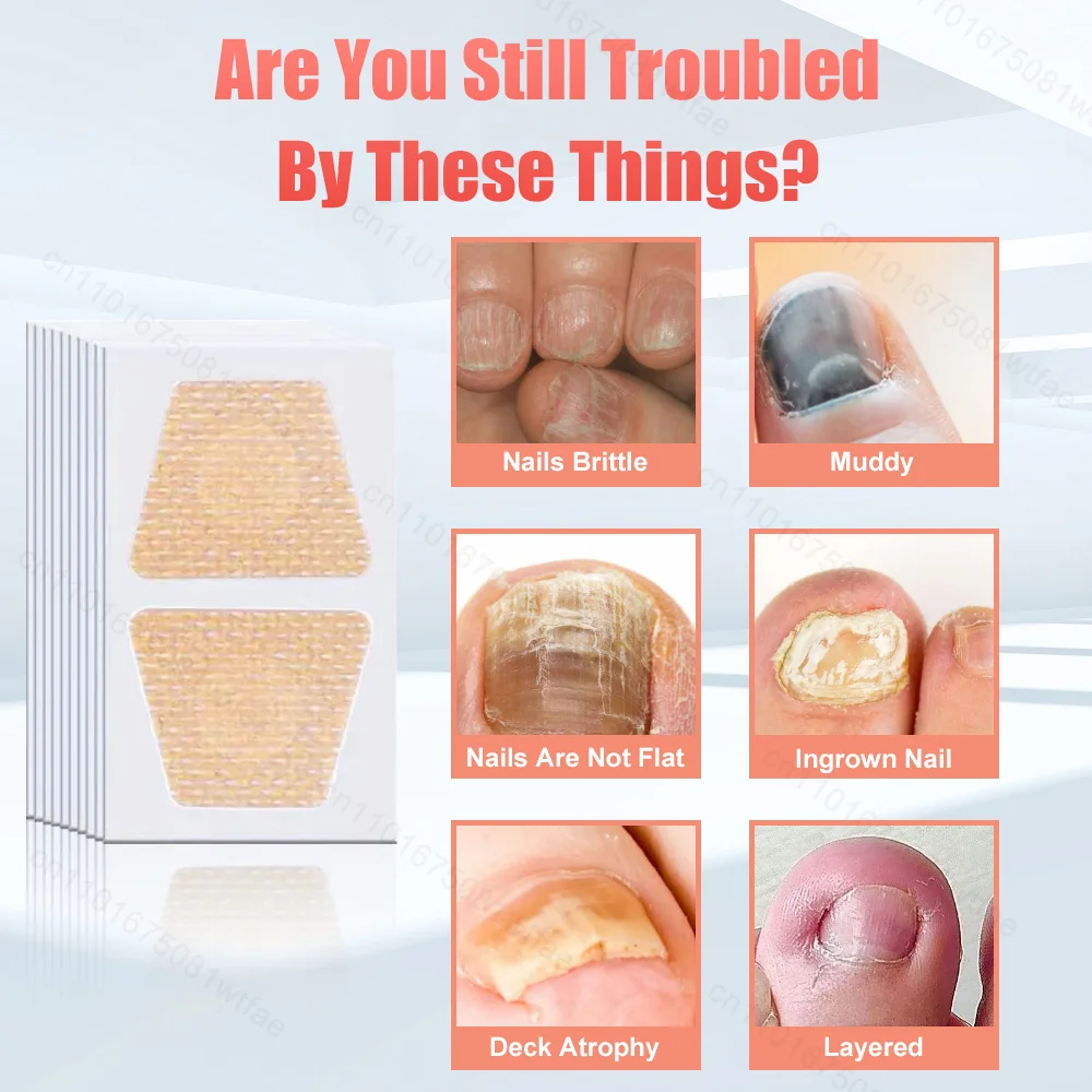 Toenail Fungus Treatment Patches Ingrown Correction Waterproof Sticky Nail Repair Sticker Discolored Damaged Fungal Nails