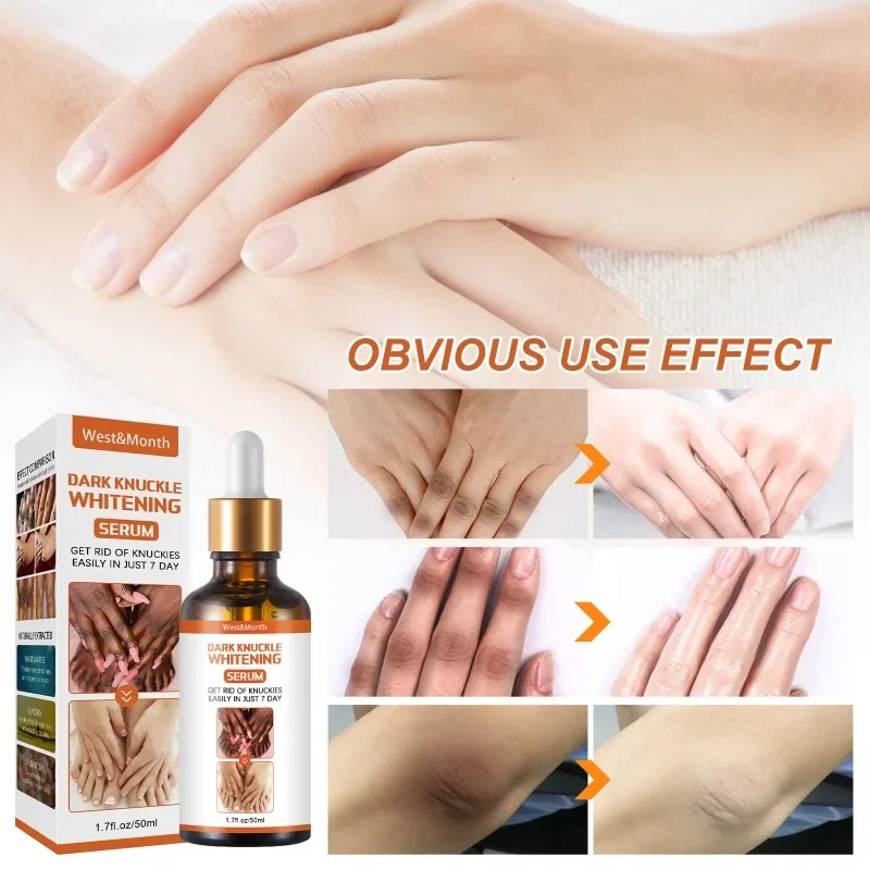 Body Serum Whitening Serum For Dark Skin