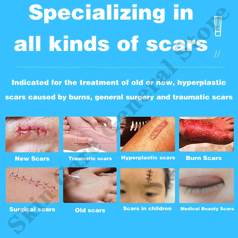 Scar Removal Cream Old Scar Cream Effective Repair Old and New Scars