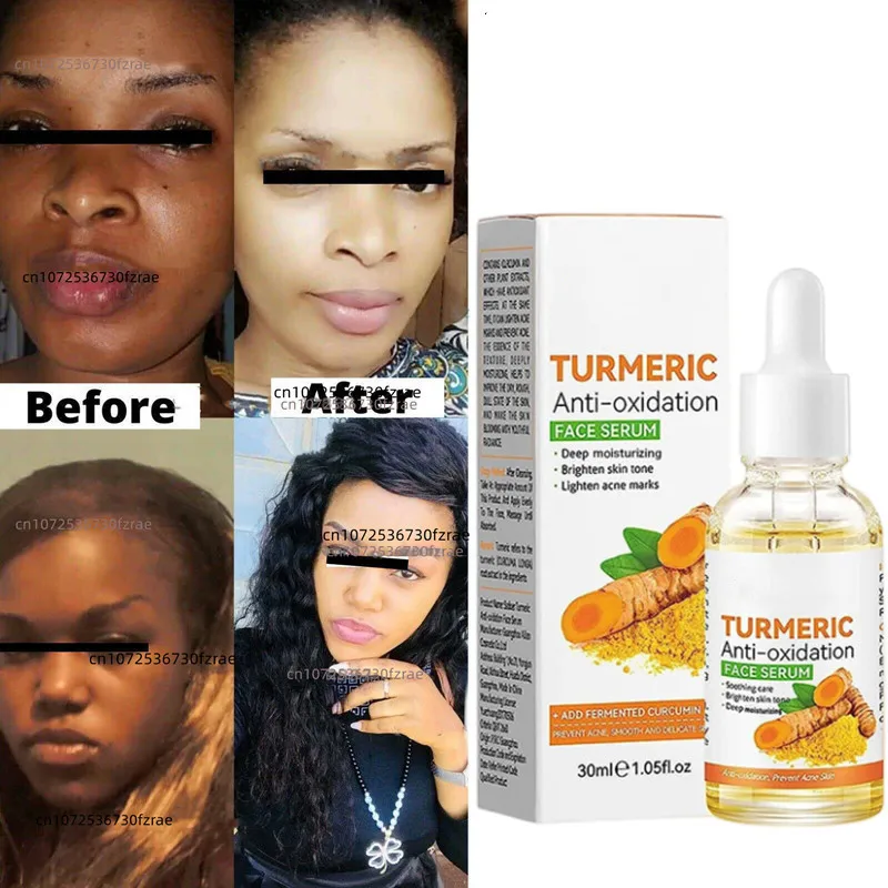 DarkSkinPermanentWhiteningLighteningBrighteningBleachingTurmeric