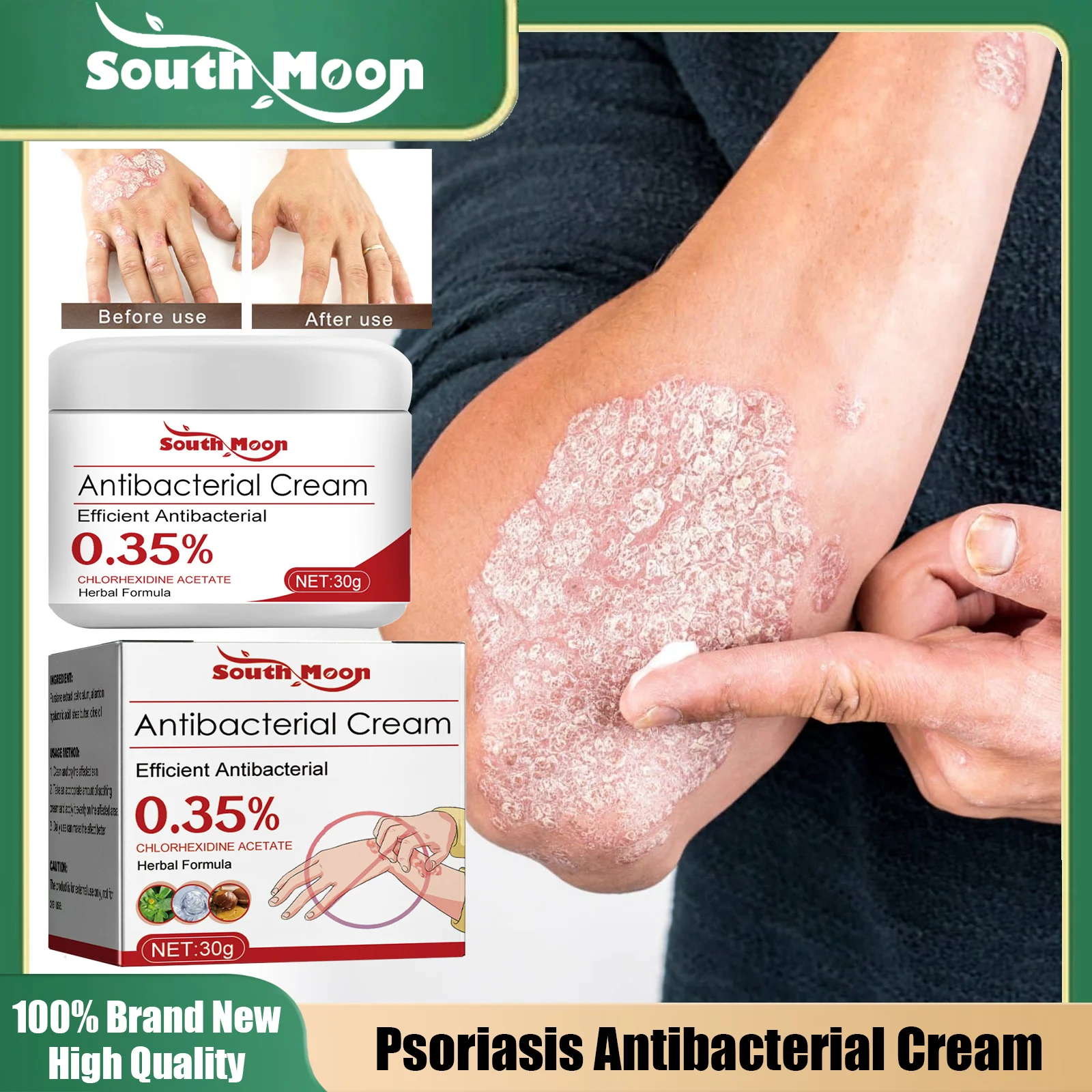 

Psoriasis Antibacterial Cream Rash Urticaria Desquamation Pruritus Relief Treatment Dermatitis Eczema Skin Anti Itching Cream