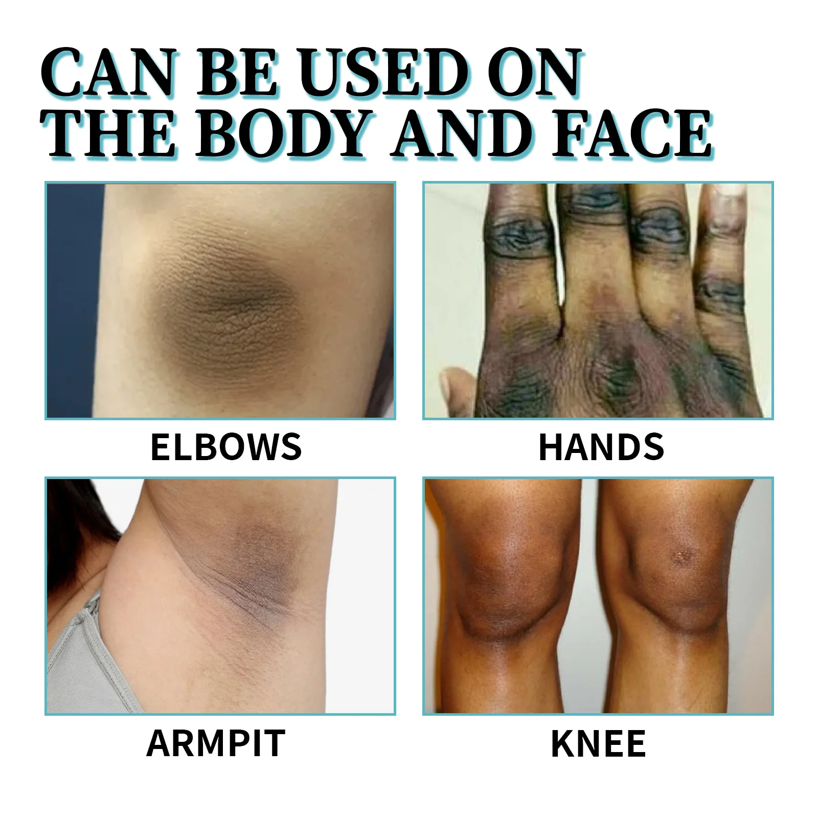 Body Whitening Cream for Dark Skin Permanently Brighten Armpit Knee Thigh Bleaching Lotion Private Part Melanin Lightening Spray 2
