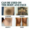 Body Whitening Cream for Dark Skin Permanently Brighten Armpit Knee Thigh Bleaching Lotion Private Part Melanin Lightening Spray 2