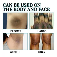 Body Whitening Cream for Dark Skin Permanently Brighten Armpit Knee Thigh Bleaching Lotion Private Part Melanin Lightening Spray 2