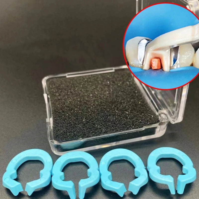 Рисунок 3 - зажимное кольцо из стоматологической смолы