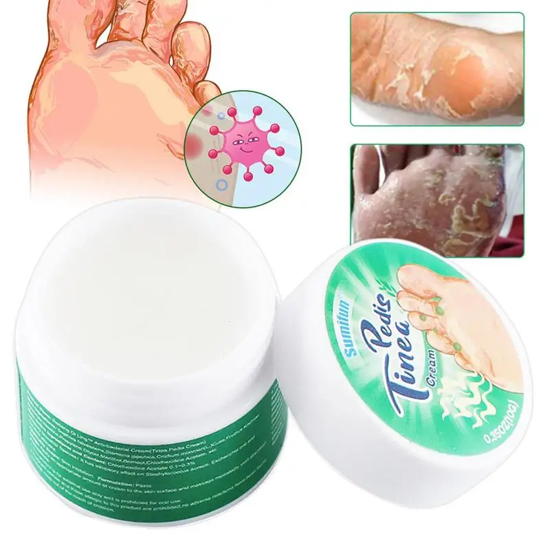 

10g Athlete's Foot Cream Anti-itch Anti-odor Anti-bacterial Foot Anti-odor Foot Sweat Foot Odor Care Cream Foot Care