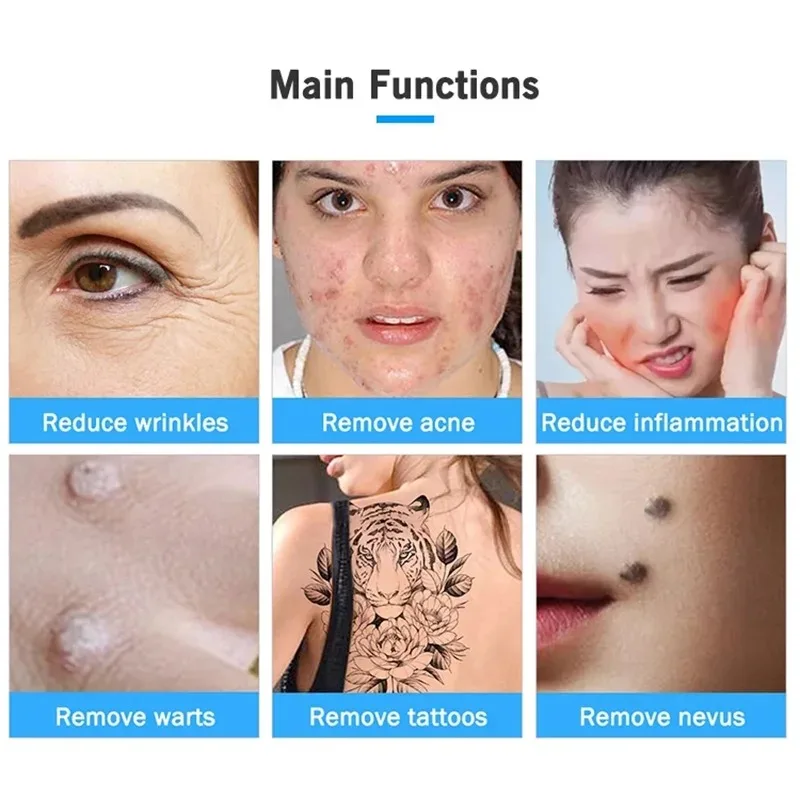 Professional 2 in 1 Ozone Plasma Pen Mole Removal Pen Sterilize Acen Skin Spot Remover Face Lifting Skin Eyelid Lift 5
