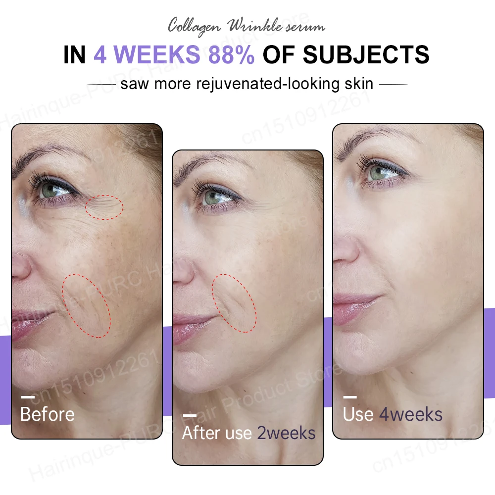 Collagen Face Serum Wrinkle Removal Hyaluronic Acid Anti Aging Fine Lines Lifting Niacinamide Brighten Serum Skin Care JoyPretty 2
