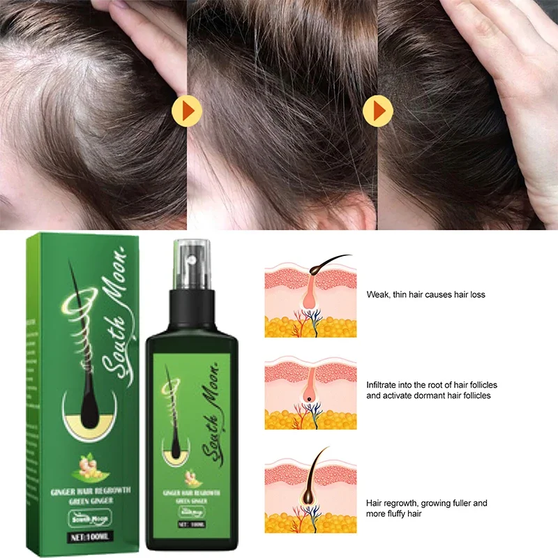 

Ginger Hair Growth Spray Strengthening-Hair Massage Scalp Dense-Hair Strengthening Hair Loss Prevention Repair Nourishing Liquid