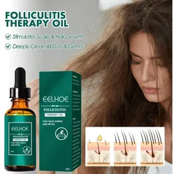 Hair Growth Essence Oil Products Growing Hair Loss Treatment Oil Beauty Health Nourish Scalp Hair Care for Men Women