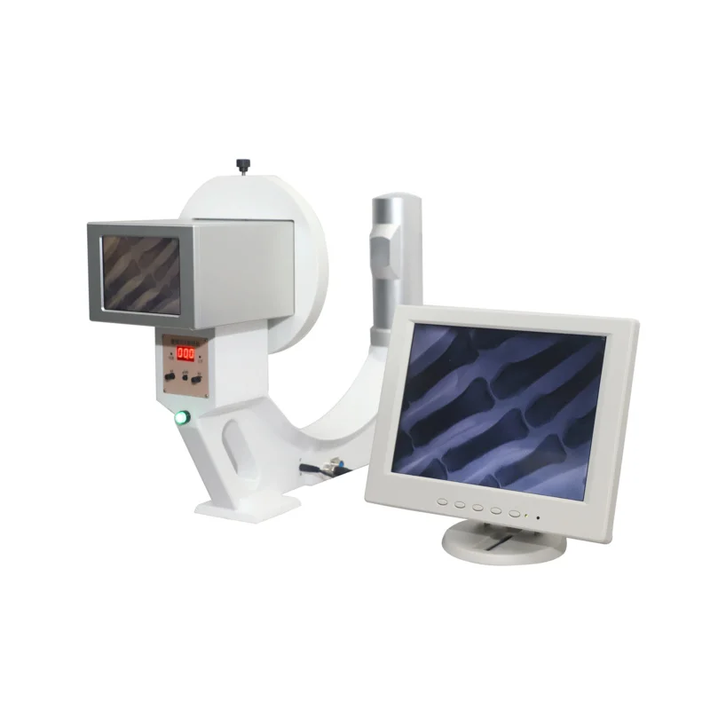 High-definition imaging design mini portable x ray machine for clinic hospital orthopedics 6