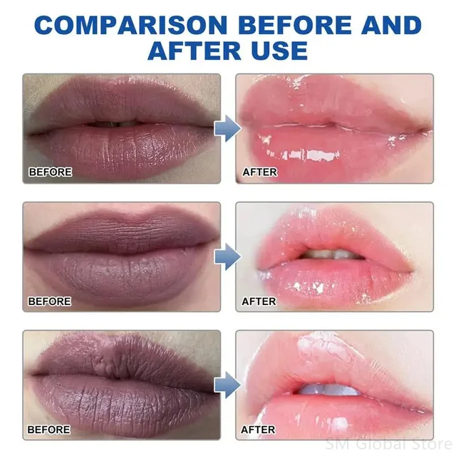 56379-116dc2.jpg Remove Dark Lip Balm Lighten Melanin Lip Mask Exfoliating Fade Lip Line Dead Skin Moisturizing Brighten Repair Lip Care Products