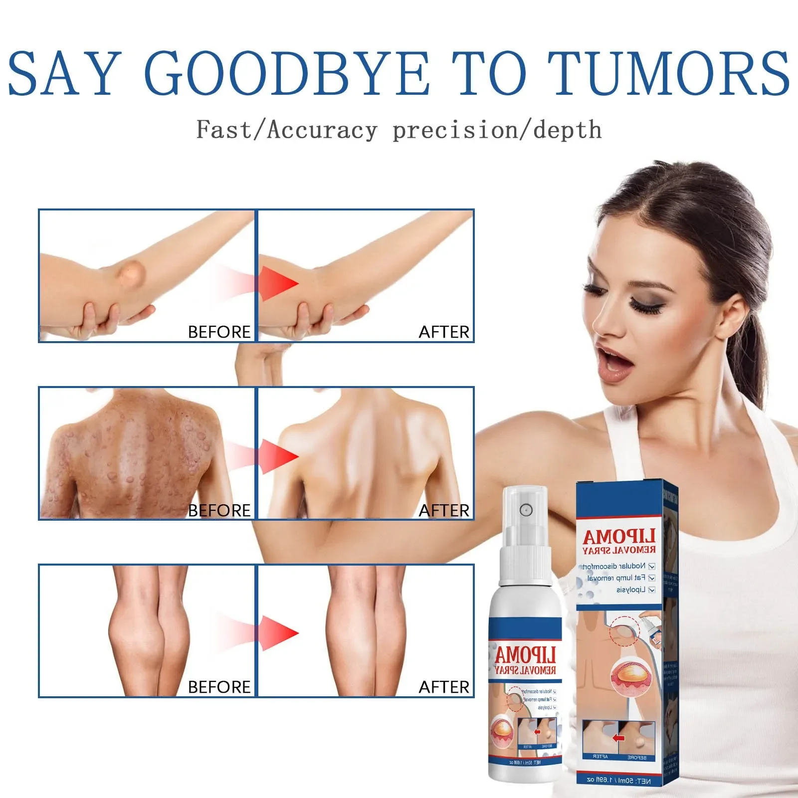 Fat knot Spray Relieves Body Lump Subcutaneous Nodule Dredging Spray Anti Tumor Mitigation Skin Swelling Pain Painless Treatment