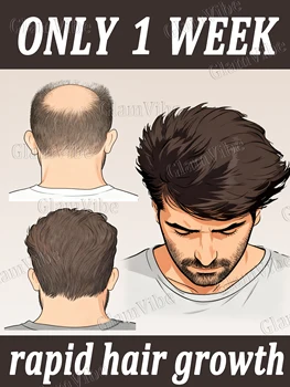 Preoccupato sui capelli diradati? Migliora dalla causa della radice, rafforza in profondità i capelli e migliora la presa.