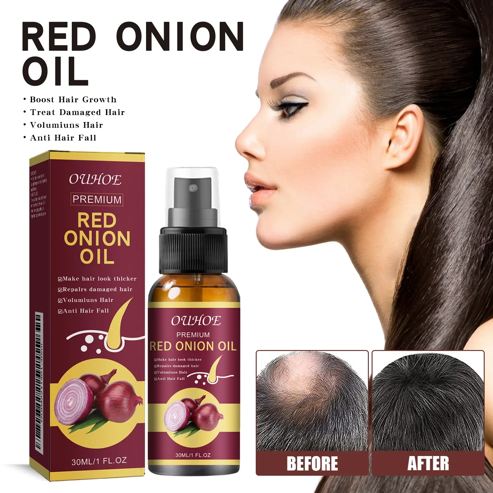 30ml Ouhoe Onion Dense Hair Essential Oil Hair Thick Soft Strong Anti-Hair Loss Solid Hairs Moisturizing Hair Care Spray