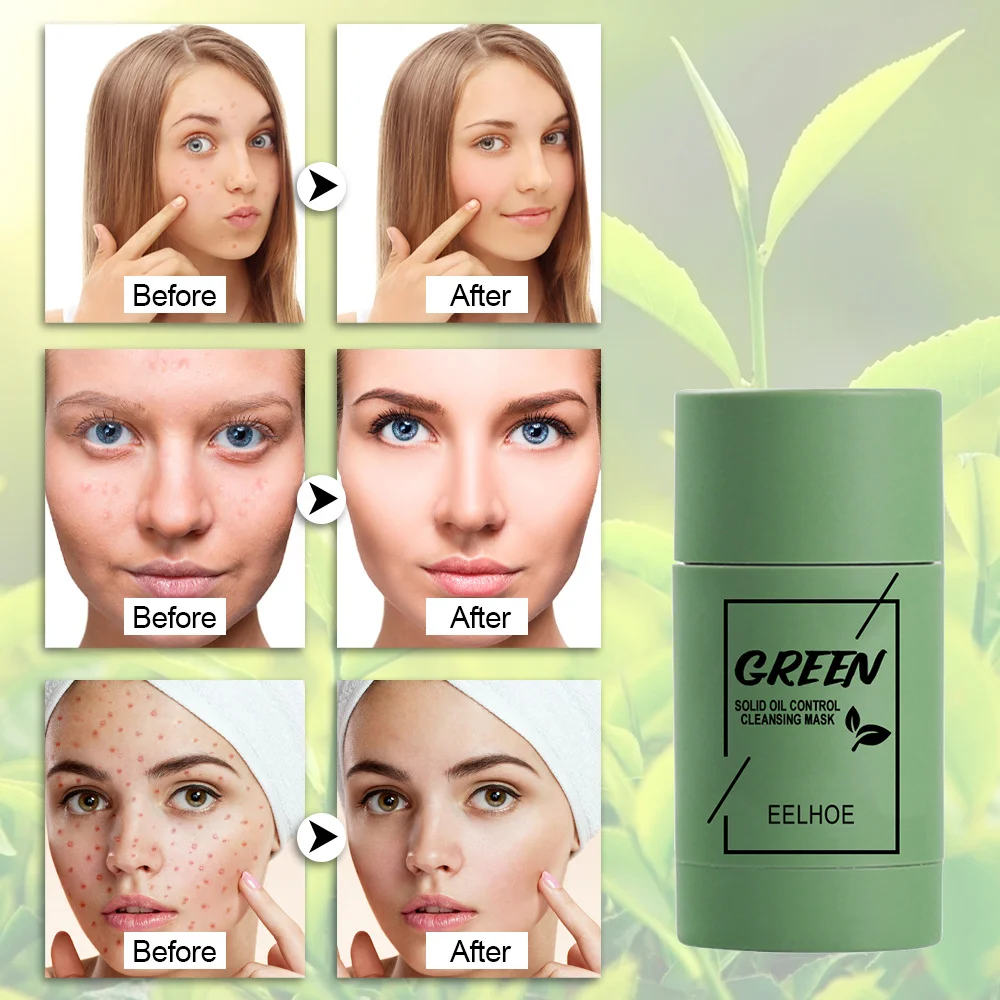 masque au thé vert pour le bâton de beauté de la élimination de contraction des soin blanchissant