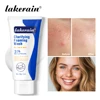 Acne Foaming Wash Benzoyl Peroxide 10% Maximum Antimicrobia Oil-Control Reduces Redness Deep Cleaning for Face & Body Skincare 1