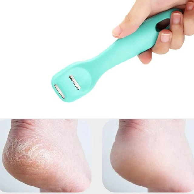 Foot File Scraper Callus Remover Feet Professional Steel Pedicure Tools Foot  Corn Removal Dead Skin Remover Foot Care - AliExpress