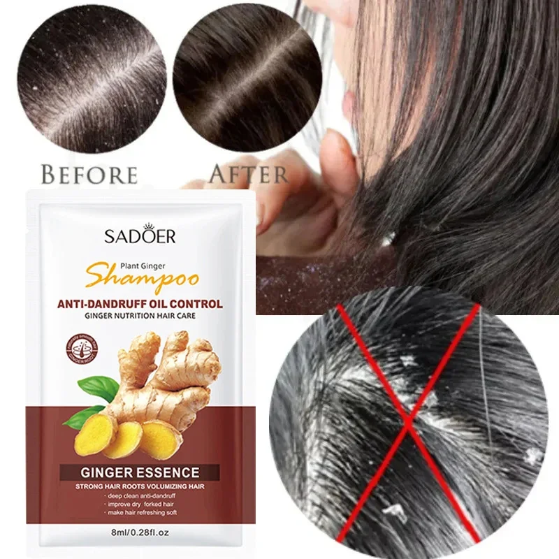 Hair Shampoo Anti-Dandruff Anti-Itch Shampoo Fast Cleaning Repair Scalp Treatment Products Oil Control Antibacterial Mite Hair Care Men Women