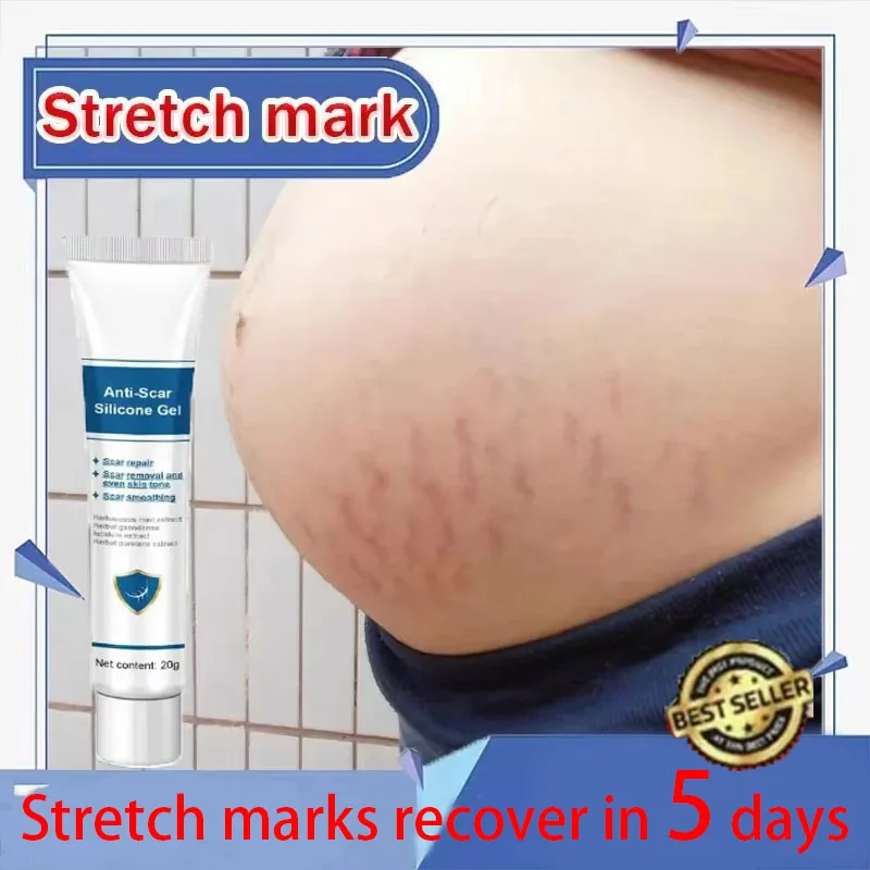 Stretch Marks Cream Eliminates Stretch Marks Enhances Elasticity Gentle Skin Care After Pregnancy