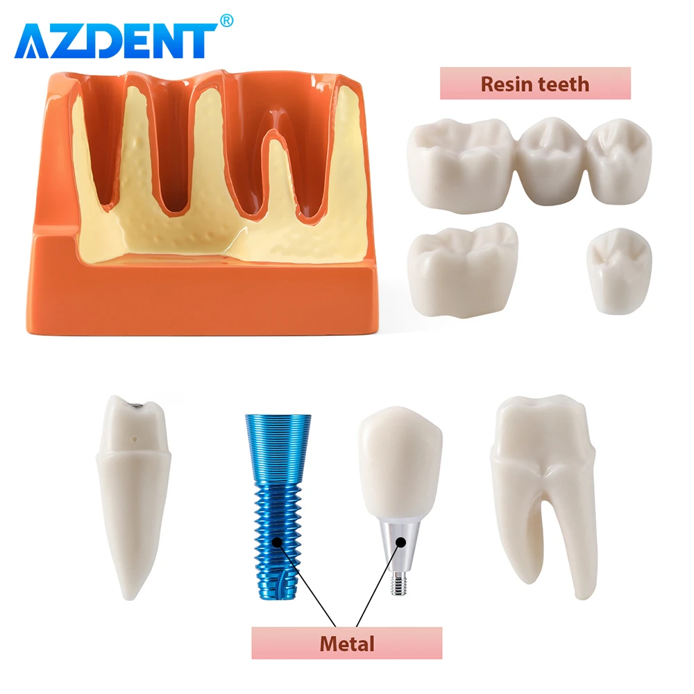 AZDENT 치과 4 배 치아 모델 임플란트 분석 크라운 브리지 데모 이동식 치과 연구 훈련 교육 모델