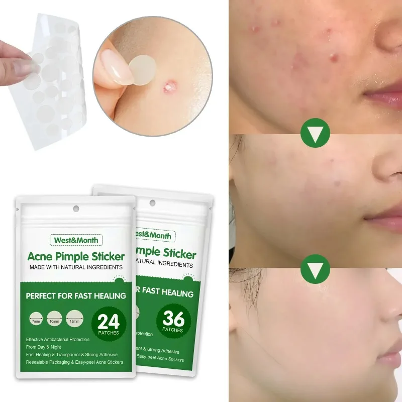 Acne pimple patch blackhead remover acne remover invisible waterproof absorb pus acne pimple remover tool cleaner Korean skin care product