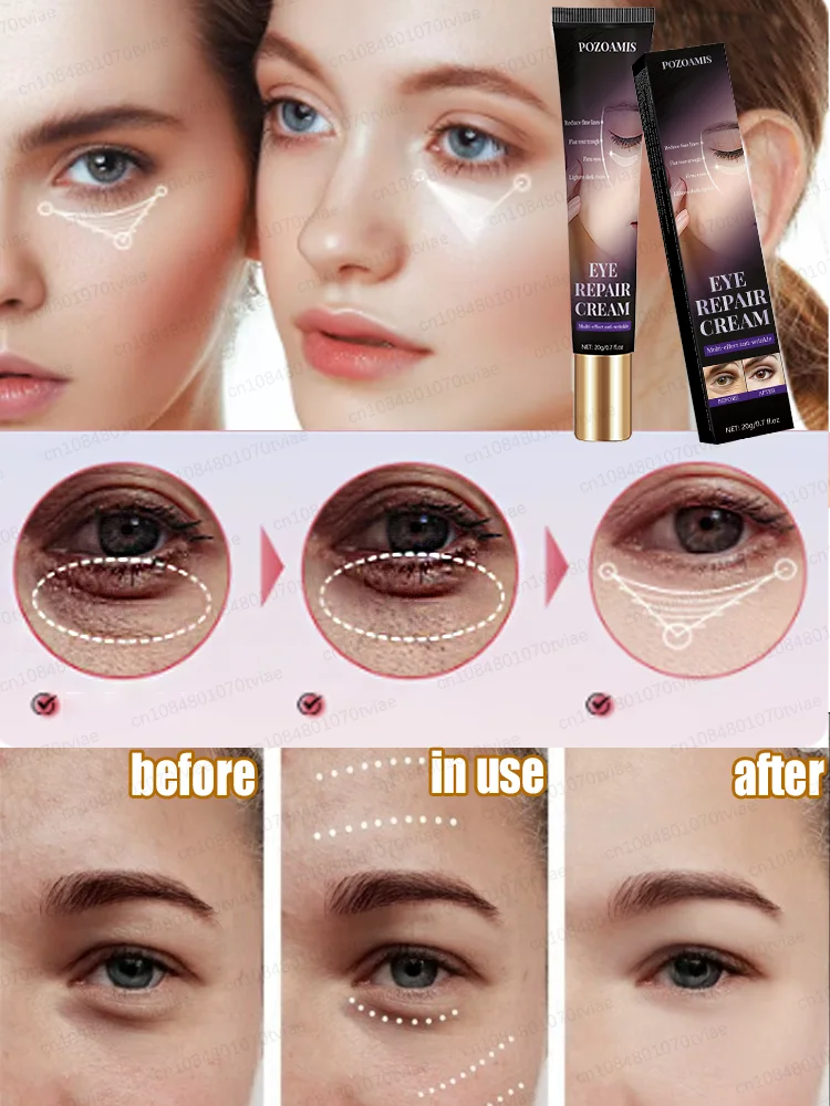 Effective eye cream eliminates wrinkles eye bags dark circles tightens skin brightens skin in 7 days beauty enhancement product
