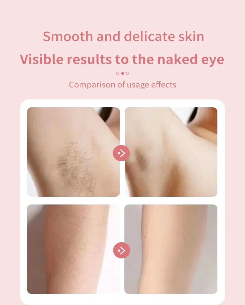 Beautyglide Pro