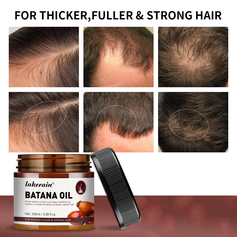 Hair Growth Oil for Scalp Moisturize