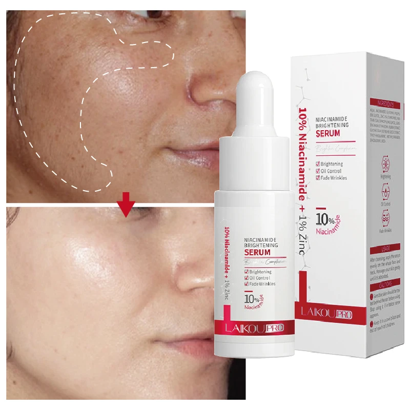 

Whitening Freckle Serum Remove Dark Spots Freckle Essence Anti-Aging Niacinamide Fade Pigmentation Melasma Moisturize Skin Care