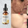 Vitamin C Whitening Serum Remove Freckles Dark Spots Face Essence Fade Melasma Melanin Brighten Repair Dull Skin Care Cosmetics 1