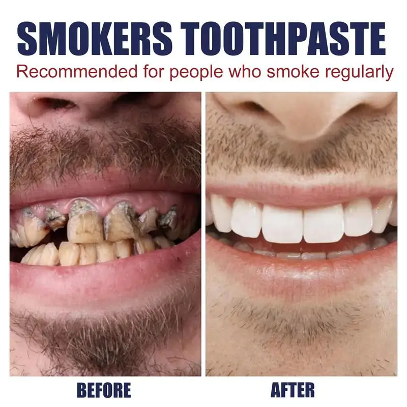 Dental Calculus Remover Teeth Whitening Spray Toothpaste Cleaning Oral Hygiene Removal Halitosis Plaque Stains Fresh Breath Care dental calculus remover