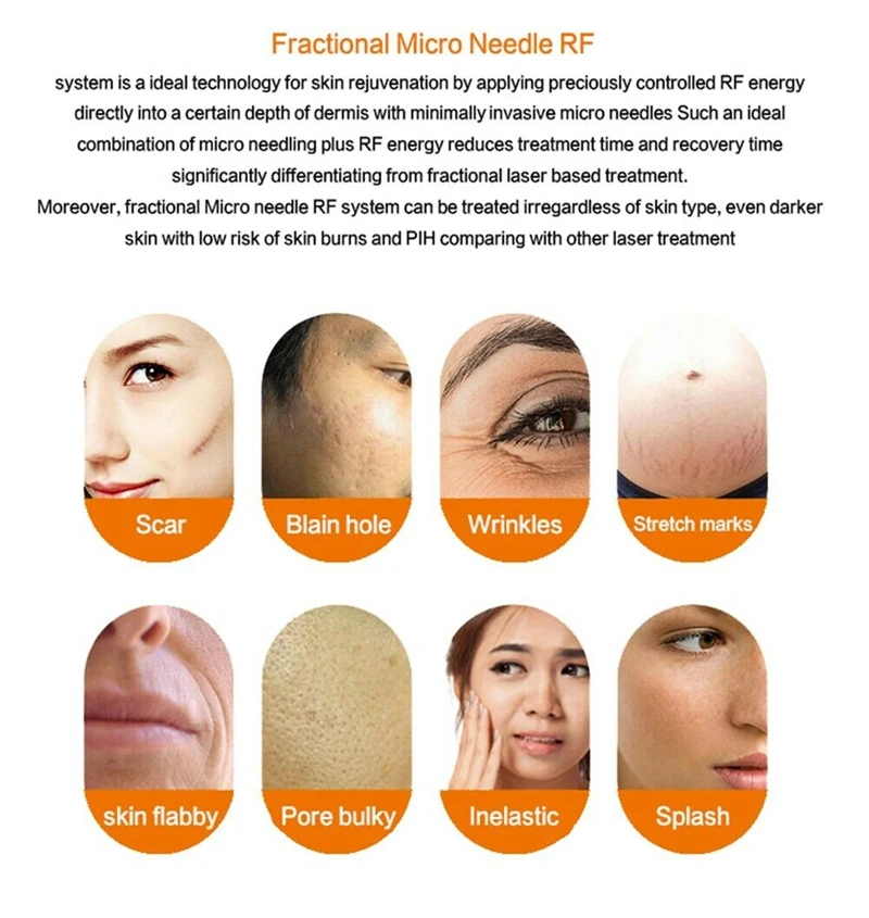 Microneedling Needle Cartridge Microneedling Cartridge Disposable Microneedle Cartridge Gold Plated 10/25/64 Pins Nano Tips for Fractional RF Machine Anti Stretch Marks Scars