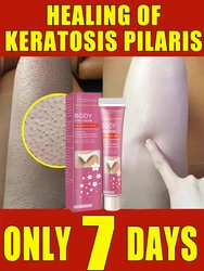 Body Lotion Keratosis Pilaris Cream Strawberry Leg Removal Skin Pimple Removal