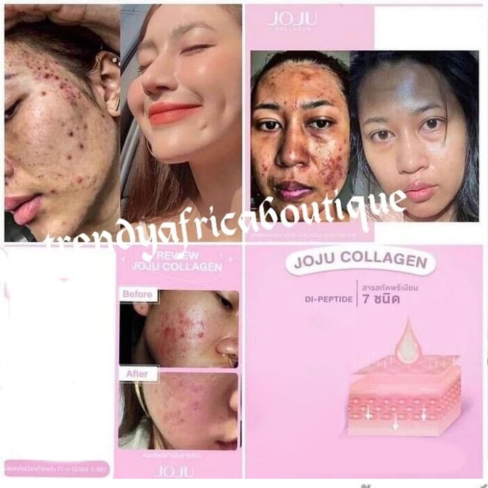 3X JOJU Collagen Dipeptide Reduce Acne Dark Spots Freckles oil control Smooth Lightening Whiten and brighten Younger Skin Care