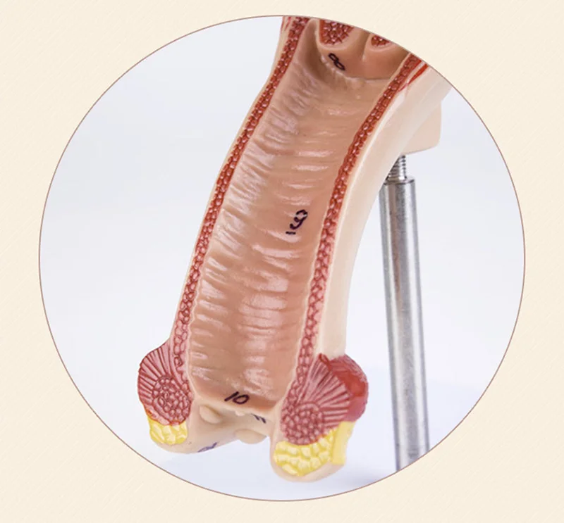 útero, anatomia humana anatômica, ferramentas didáticas médicas, 1:1