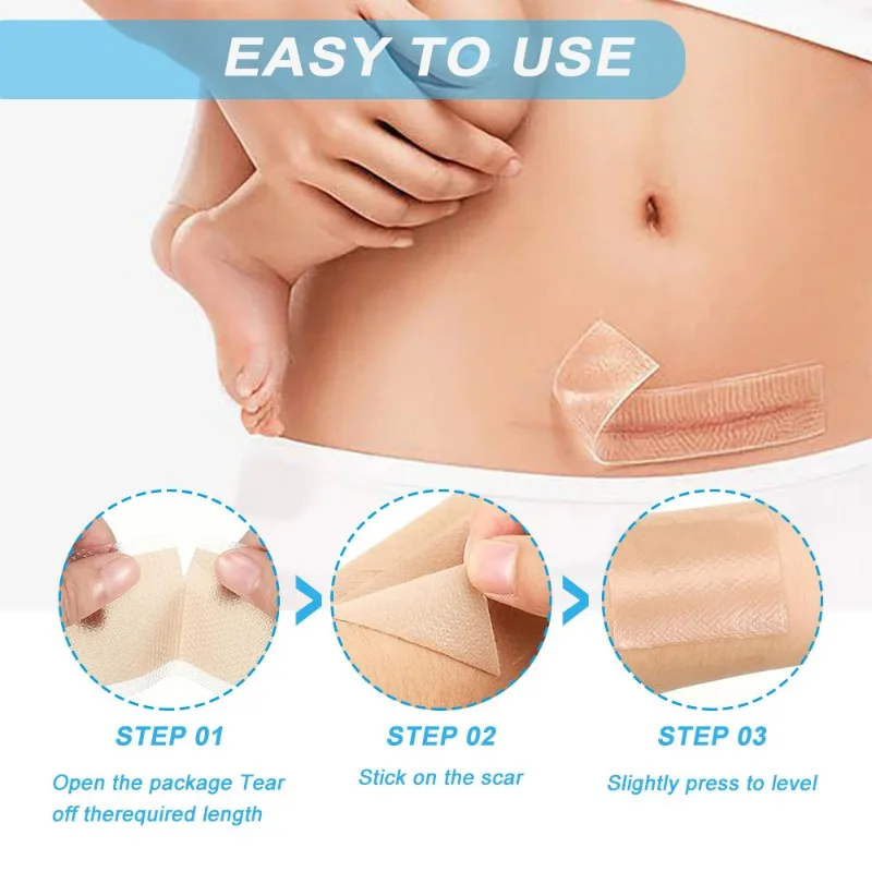 Silicone Scars Sheets Keloid Bump Removal Strips Scars Reducing Treatments Surgical Scars Burn Tummy Tucks Acne C-Section 1 Roll