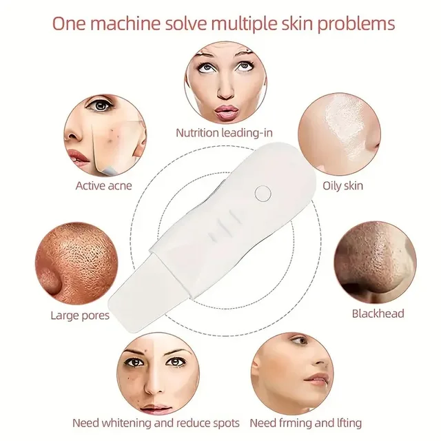 Ultrasonic Skin Scrubber Electric Ultrasonic Peeling Machine Deep Vibrate Facial Cleaner Acne Removal Blackhead Pore Cleaner 4